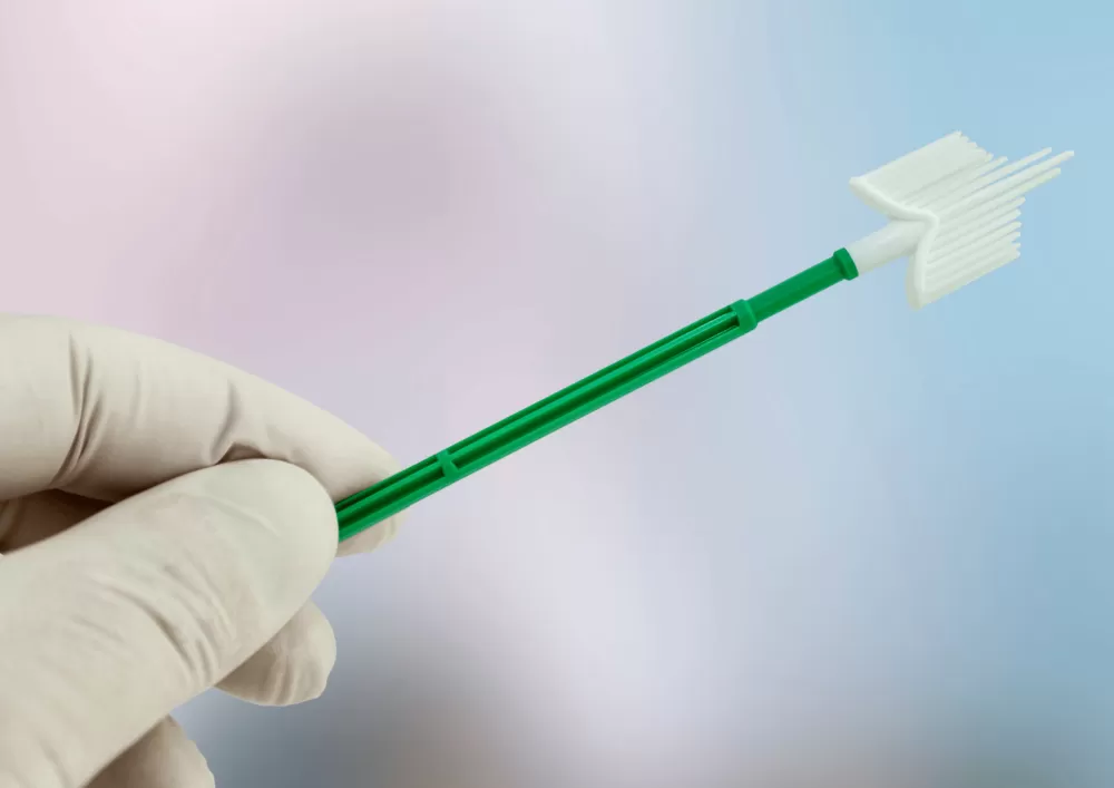Nowe zasady badań przesiewowych: koniec klasycznej cytologii od 2026 roku